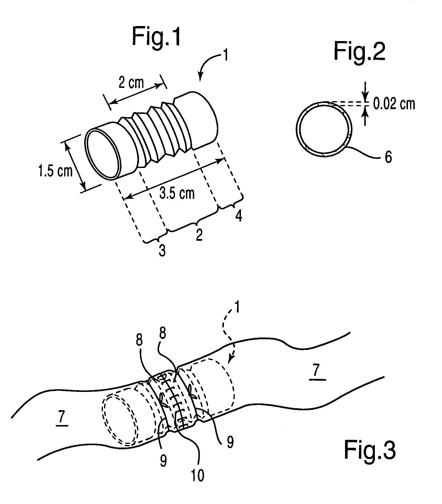 Visceral anastomotic device and method of using same