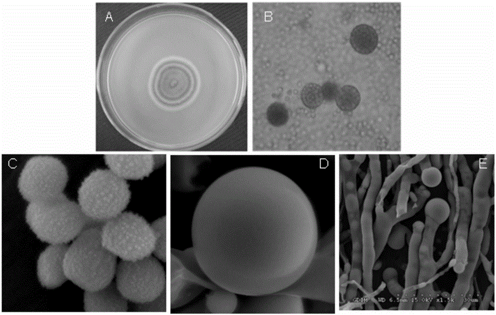 Preparation method of mycelium extract of strain culture of marine fungus umbelopsis sp.