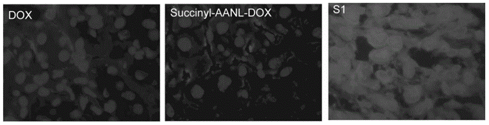 Preparation and application of molecular site-directed targeted and activated short peptide adriamycin