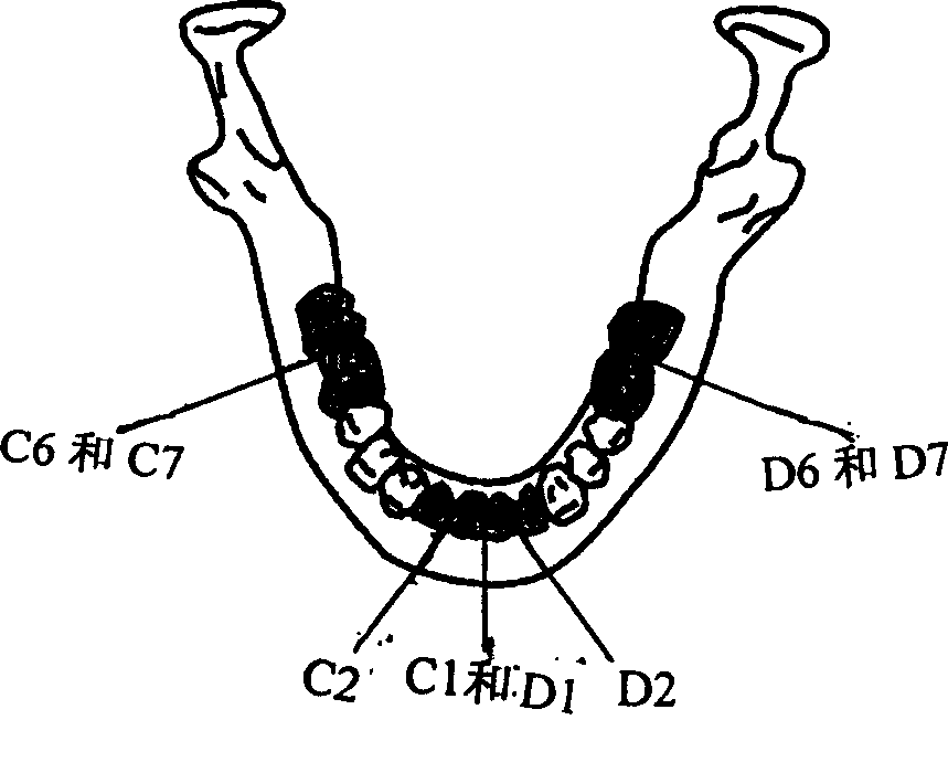 Biomechanical model of human lower jawbone