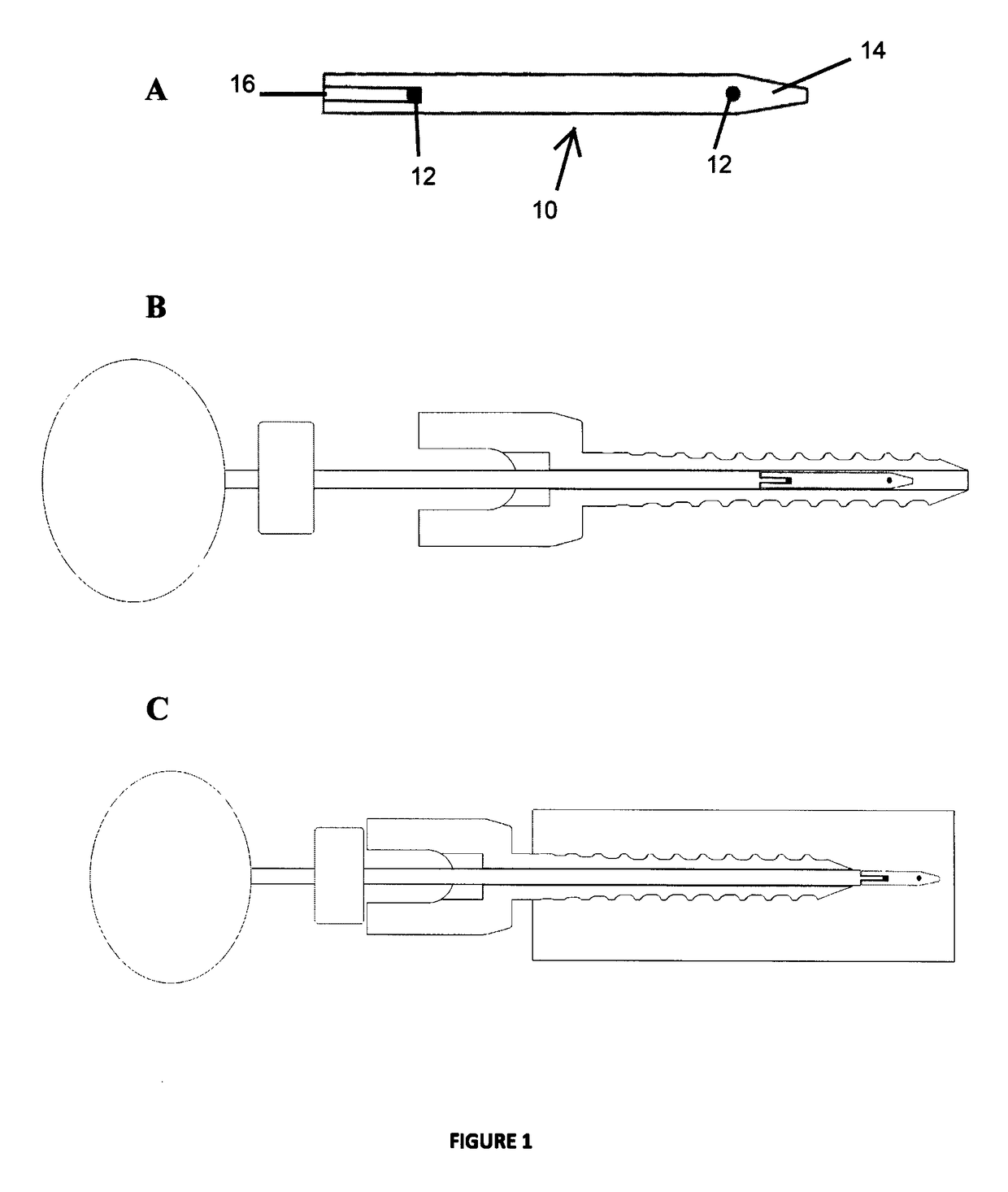 Method of detecting movement between an implant and a bone