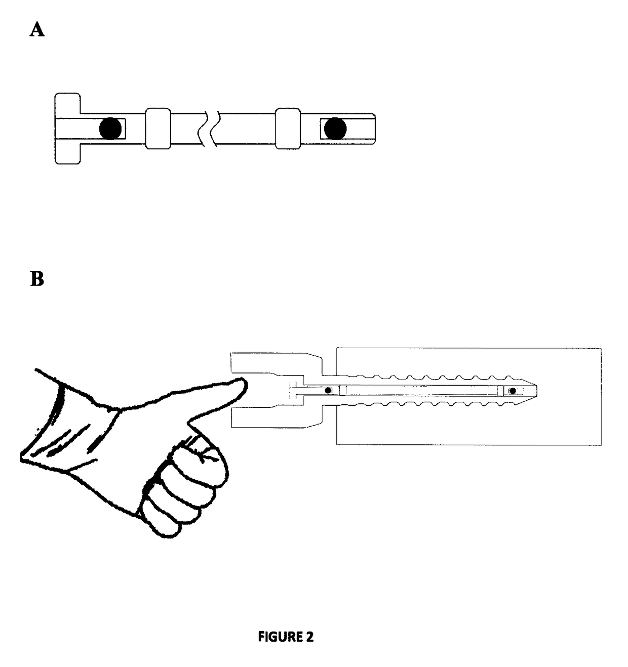 Method of detecting movement between an implant and a bone