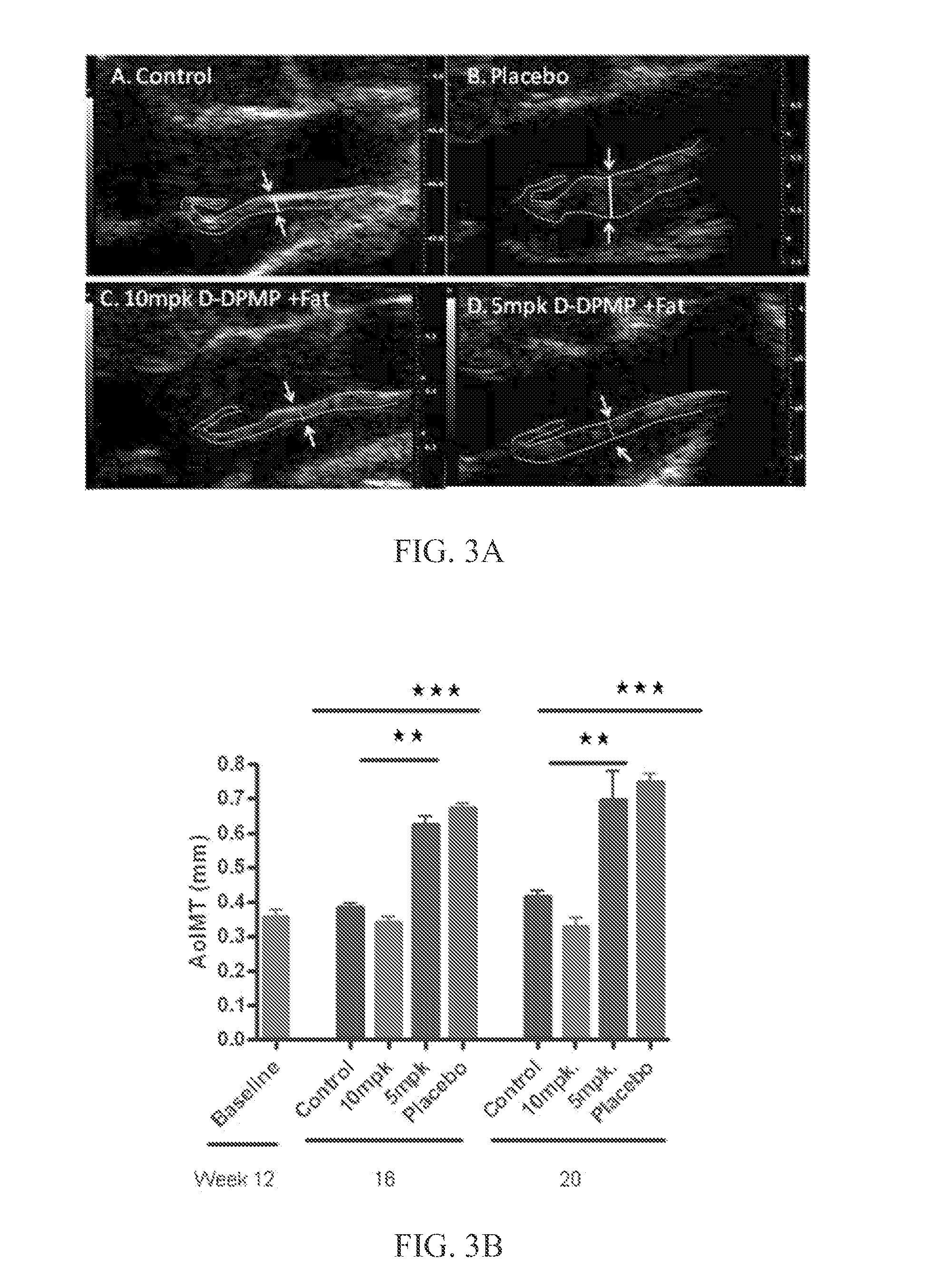 Compositions and methods for treating cardiac hypertrophy