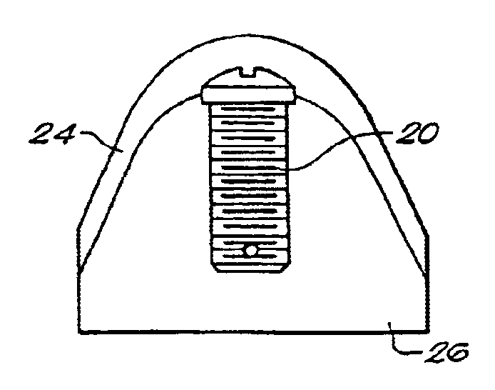 Method for fabricating endodontic, orthodontic, and direct restorations having infused ceramic network