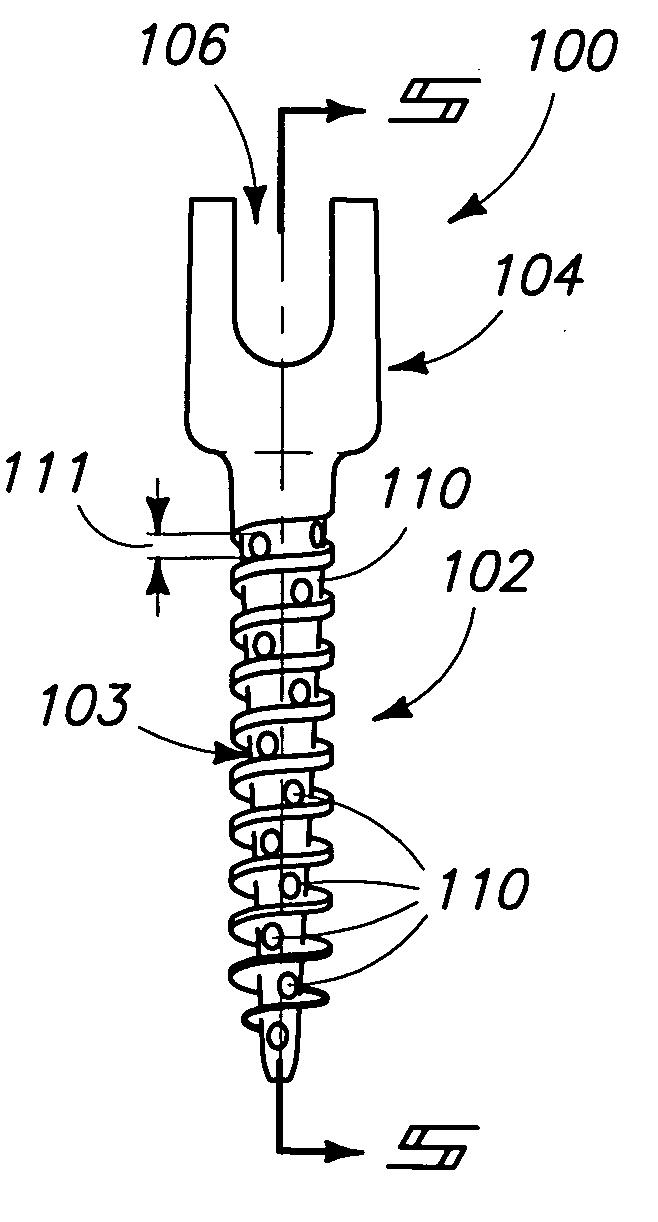 Screws configured to engage bones, and methods of attaching implants to skeletal regions