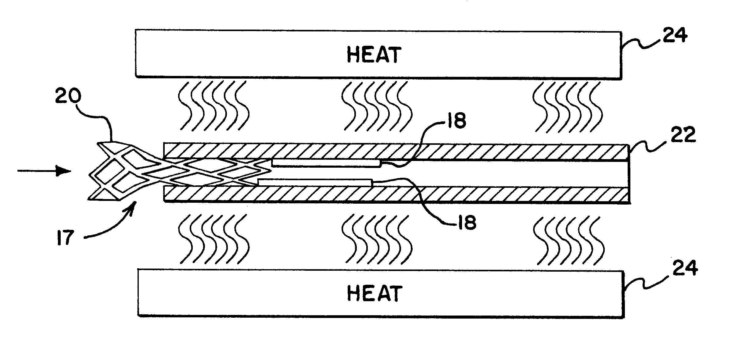 Method of manufacturing small profile medical devices