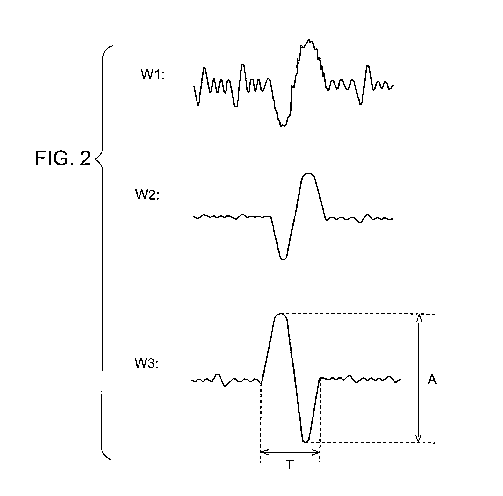 Pinching detection device