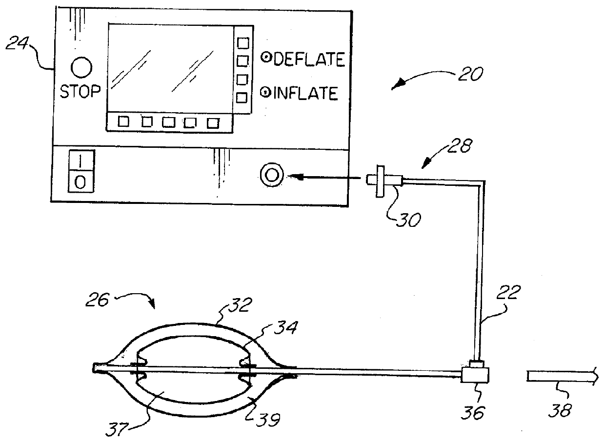 Nested Balloon Catheter for Localized Drug Delivery