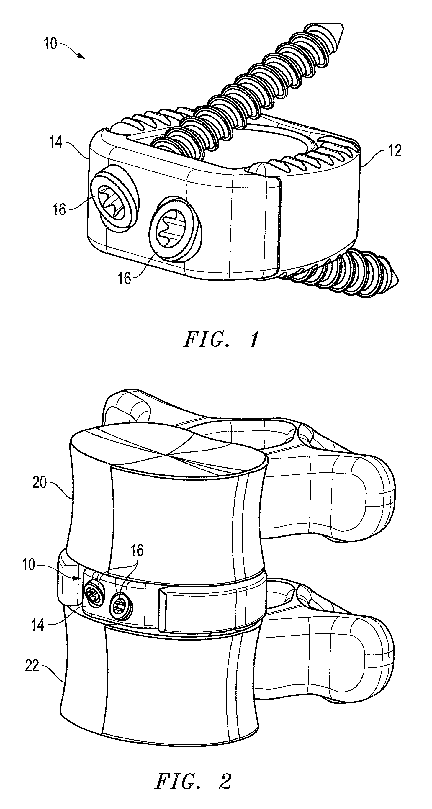 Interbody fusion device with snap on anterior plate and associated methods