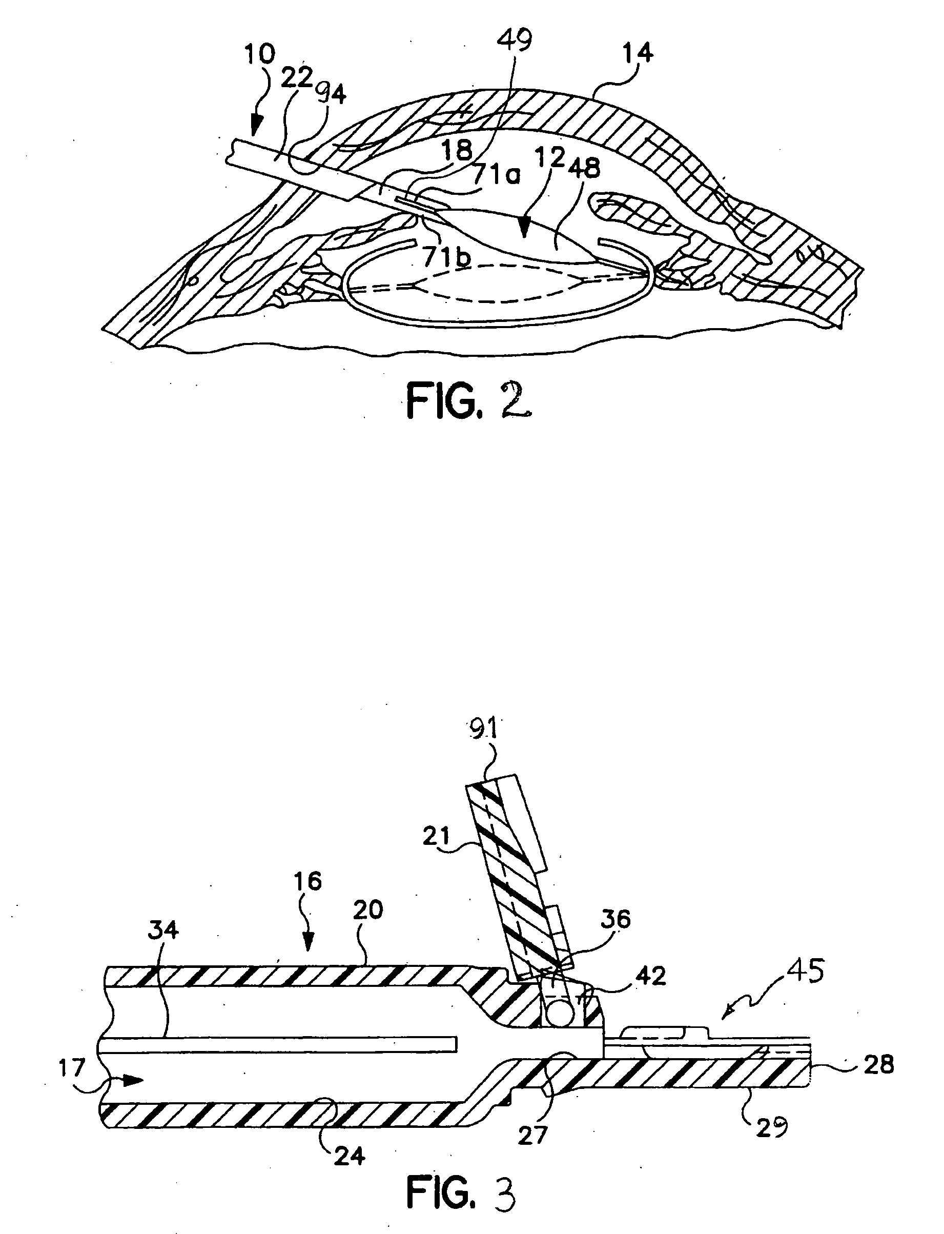 Method for limiting transfer of material between two adjacent polymeric articles