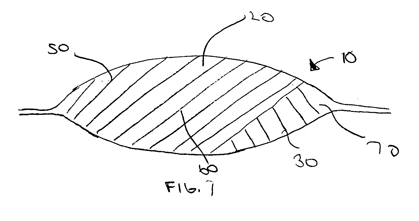 Multi-step method of manufacturing a medical device