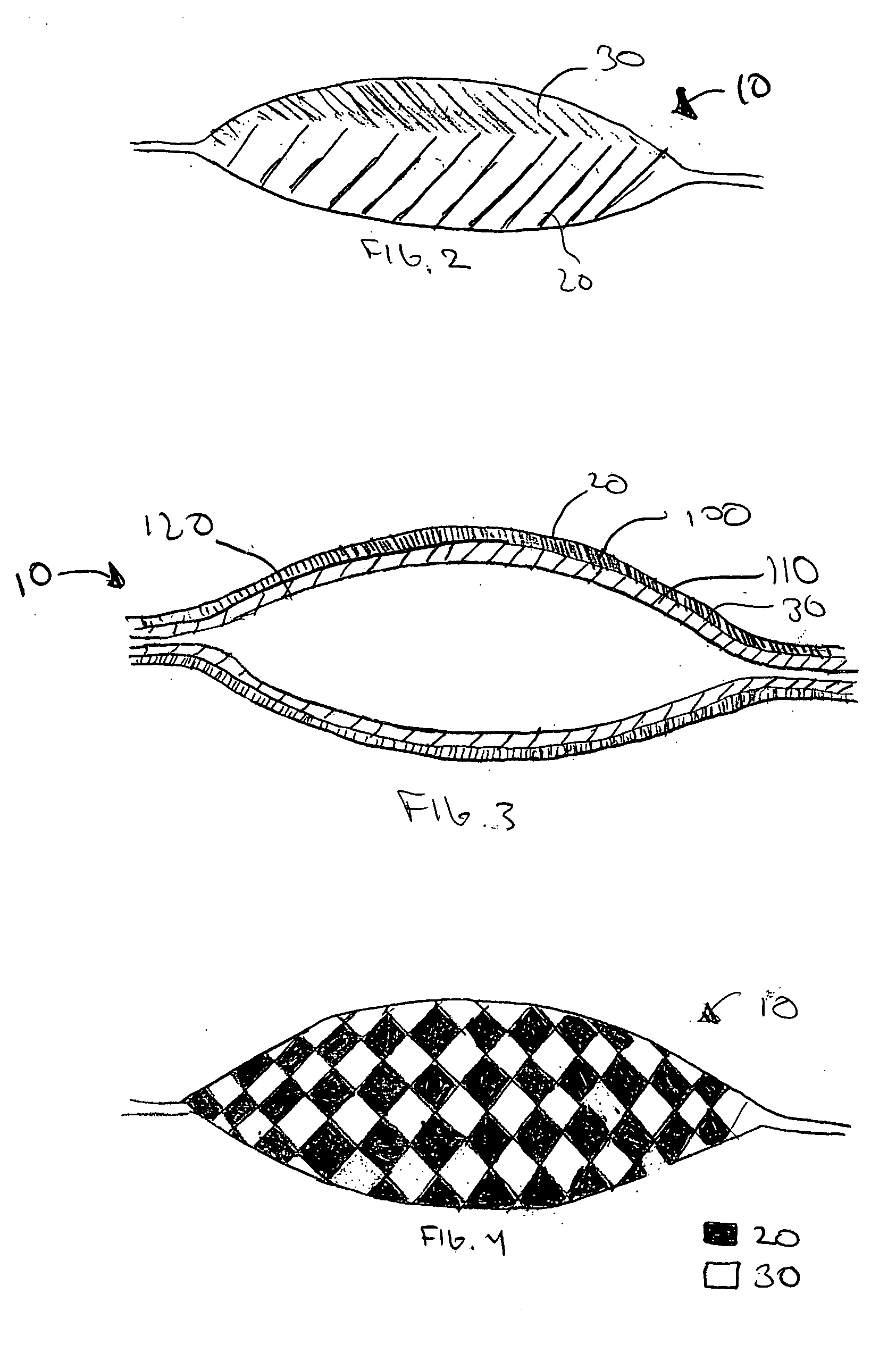 Multi-step method of manufacturing a medical device
