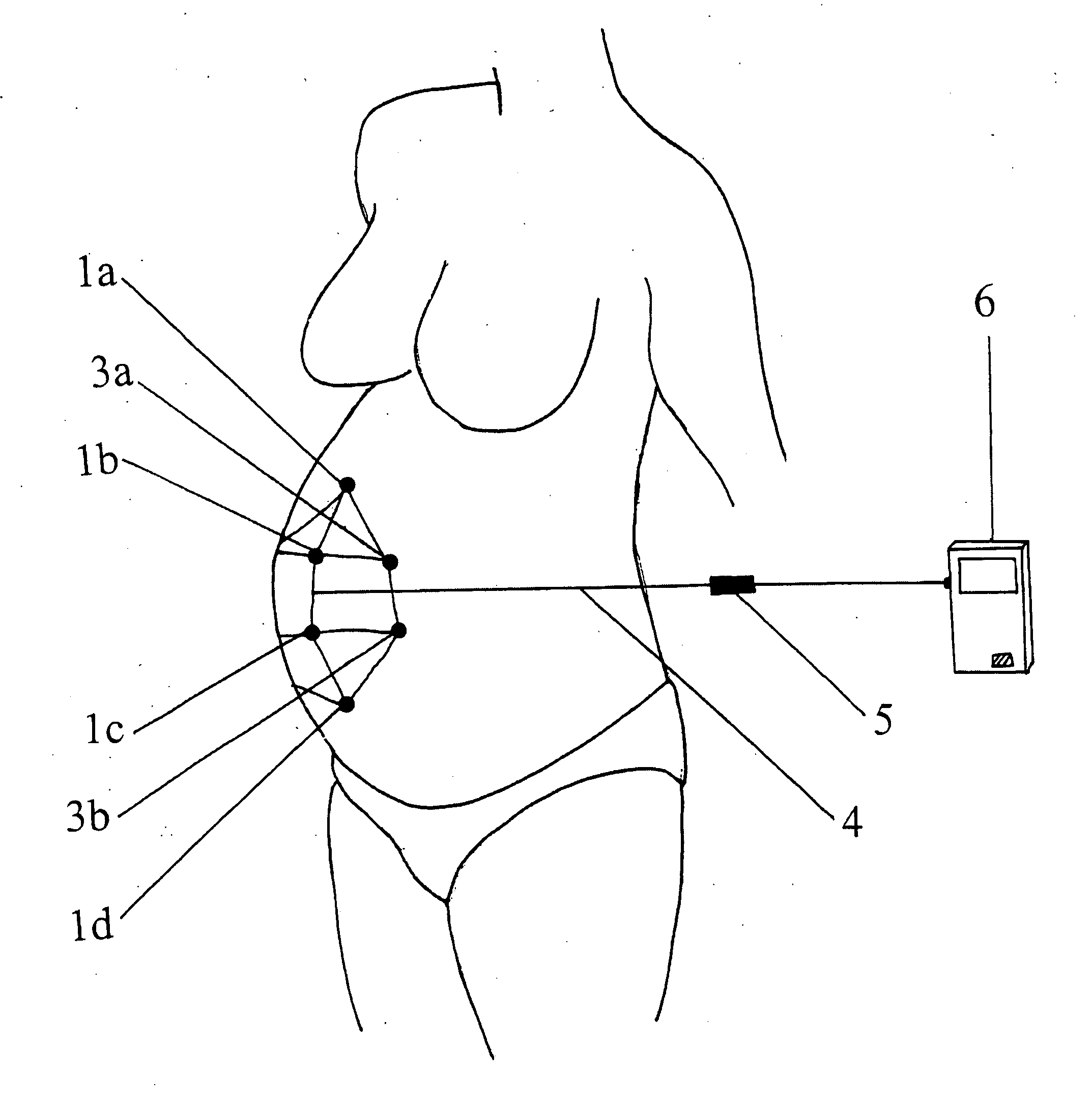 Obstetric Analgesia System