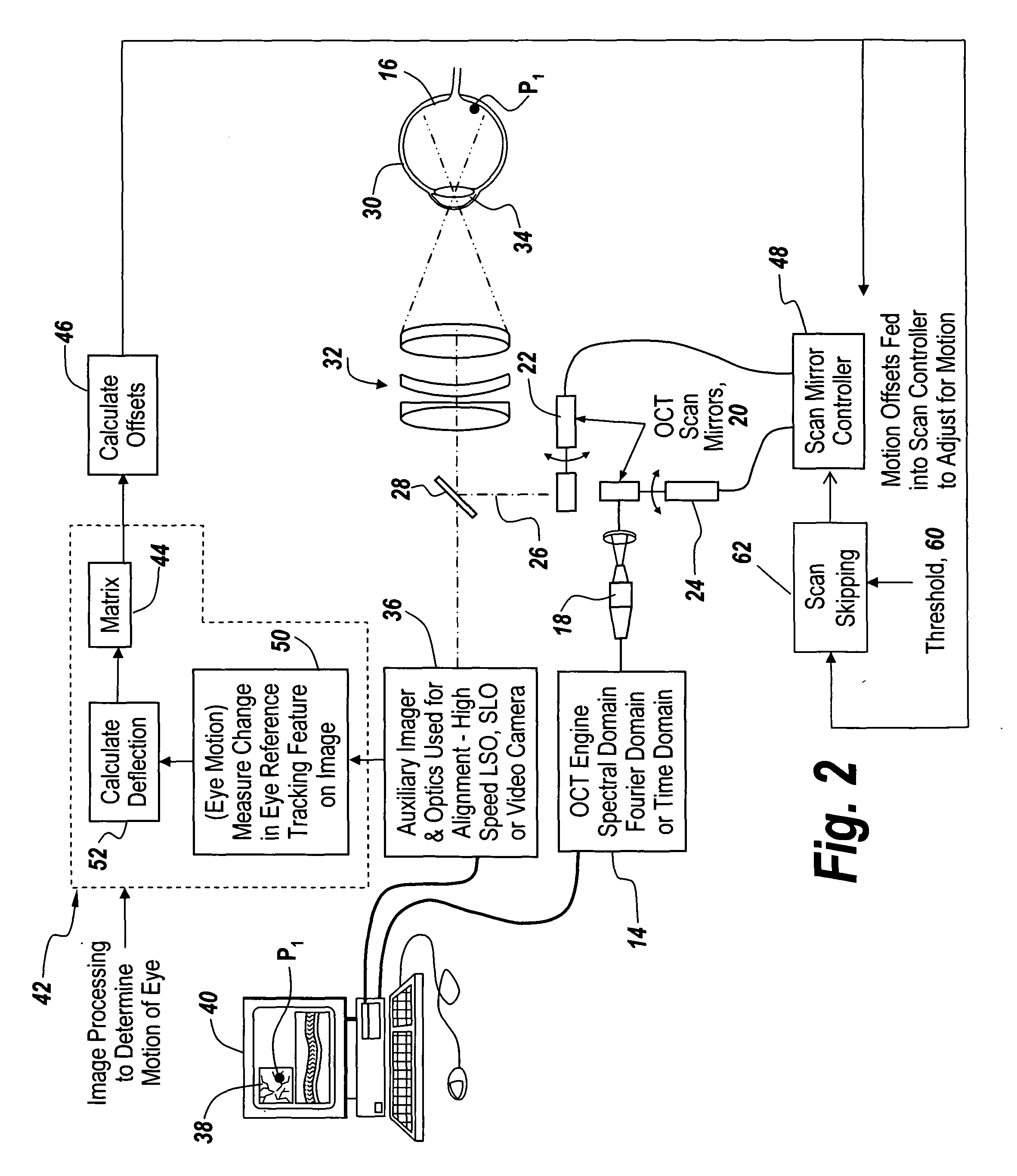 Region based vision tracking system for imaging of the eye for use in optical coherence tomography