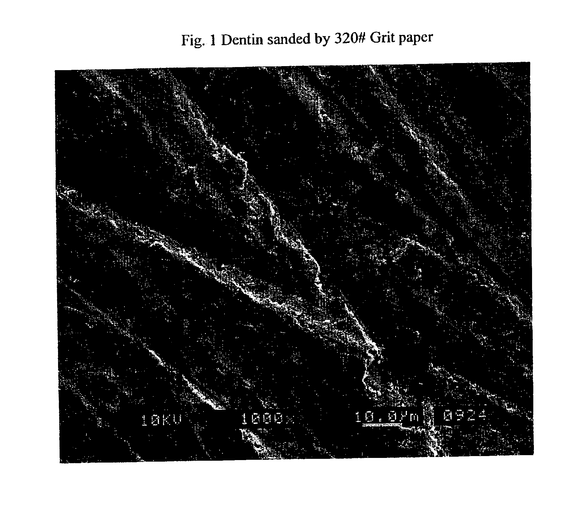 Stable self-etching primer and adhesive bonding resin compositions, systems, and methods