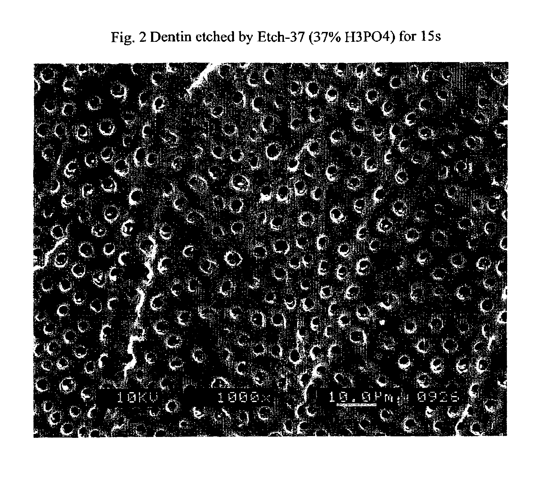 Stable self-etching primer and adhesive bonding resin compositions, systems, and methods