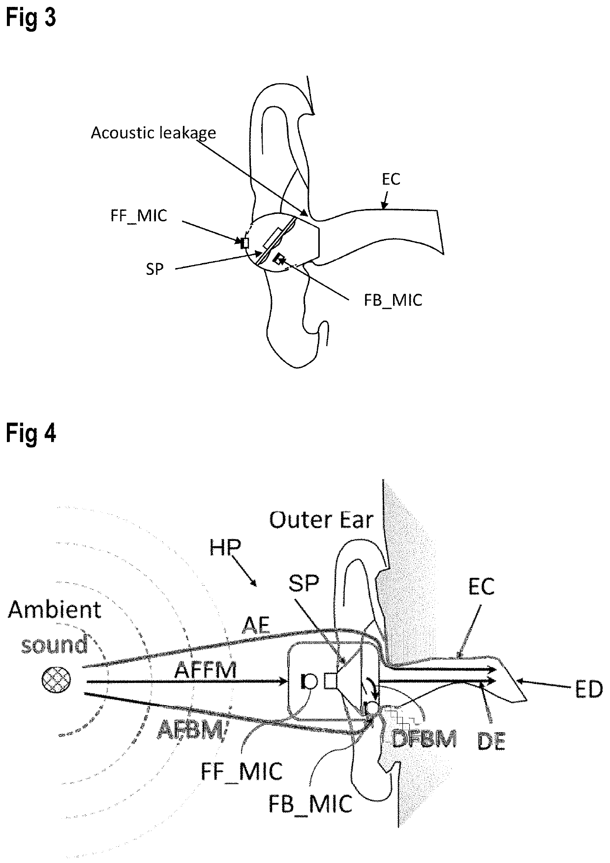 Audio system and signal processing method for an ear mountable playback device