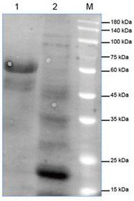 Gene for degrading tetracycline antibiotics and enzyme protein encoded by gene