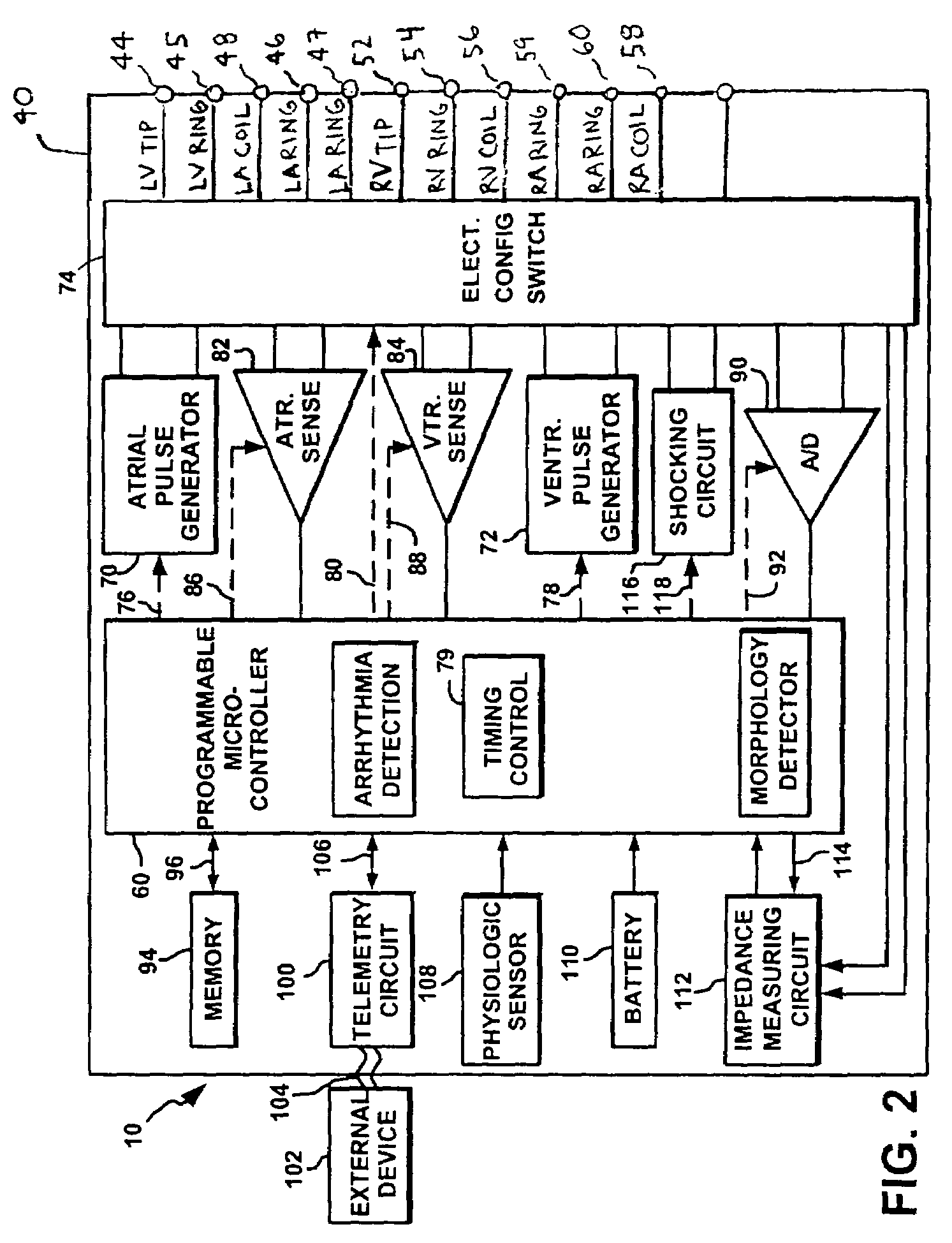 Anti-tachycardia pacing methods and devices