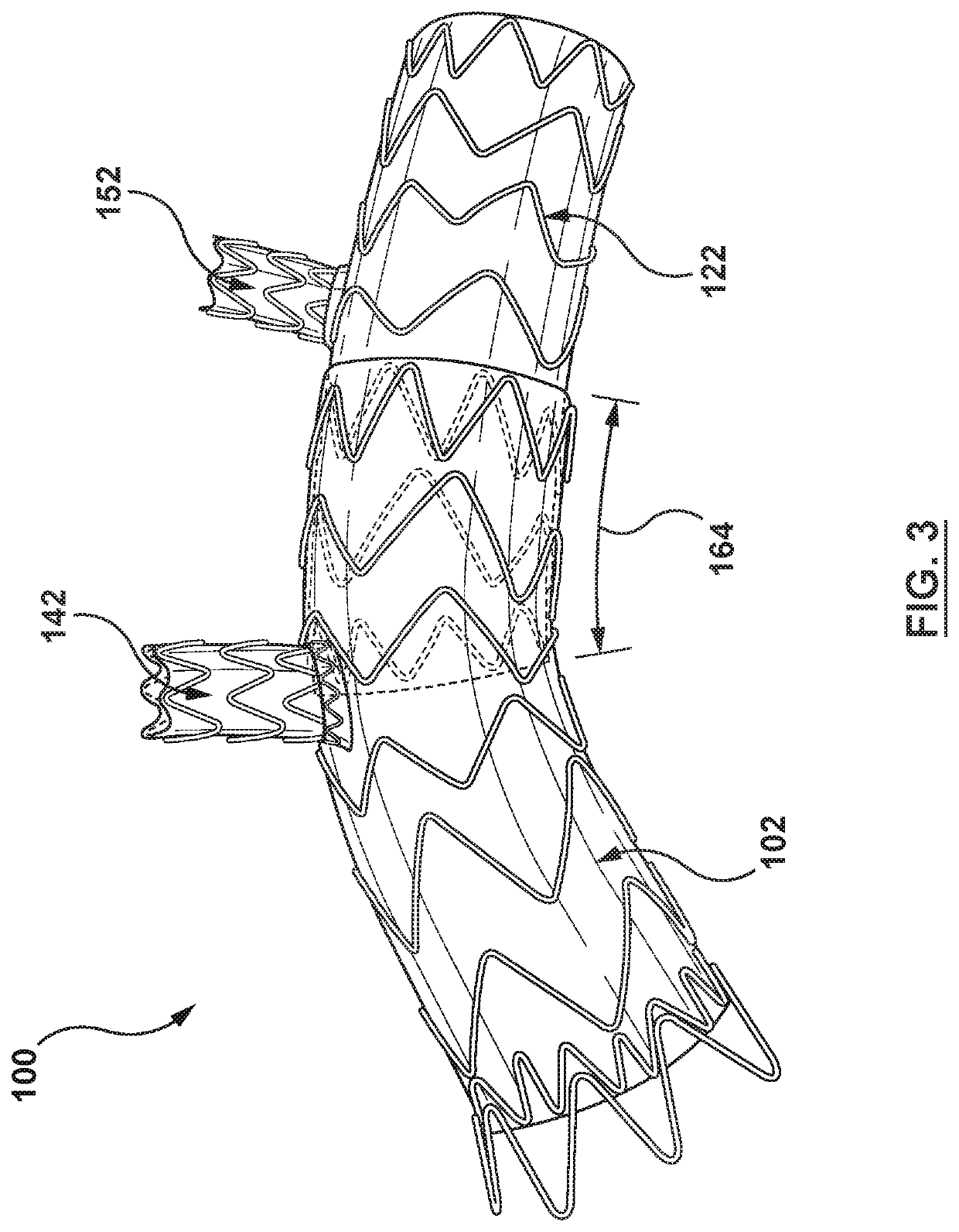 Modular aortic arch prosthetic assembly and method of use thereof