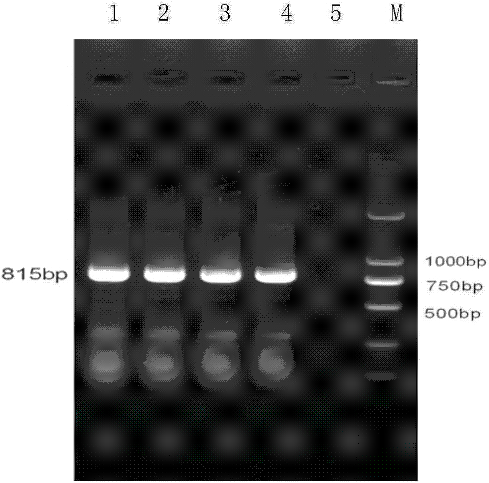 PCR (polymerase chain reaction) primer and PCR kit for detecting rhizomyidae circovirus