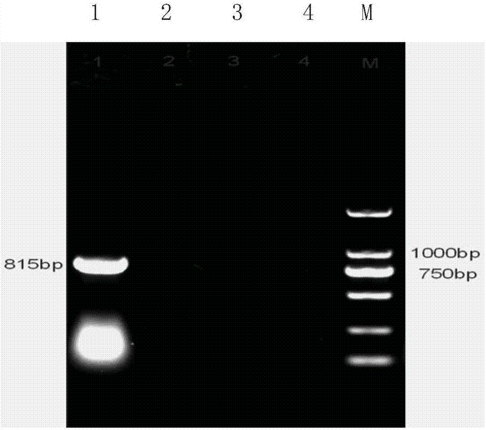 PCR (polymerase chain reaction) primer and PCR kit for detecting rhizomyidae circovirus