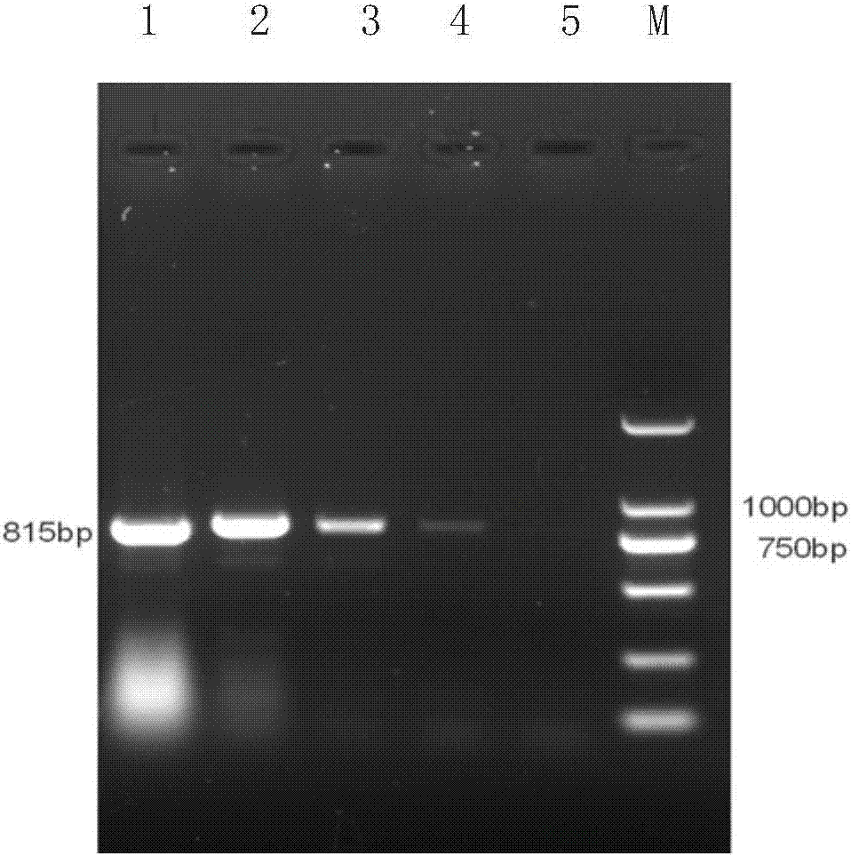 PCR (polymerase chain reaction) primer and PCR kit for detecting rhizomyidae circovirus