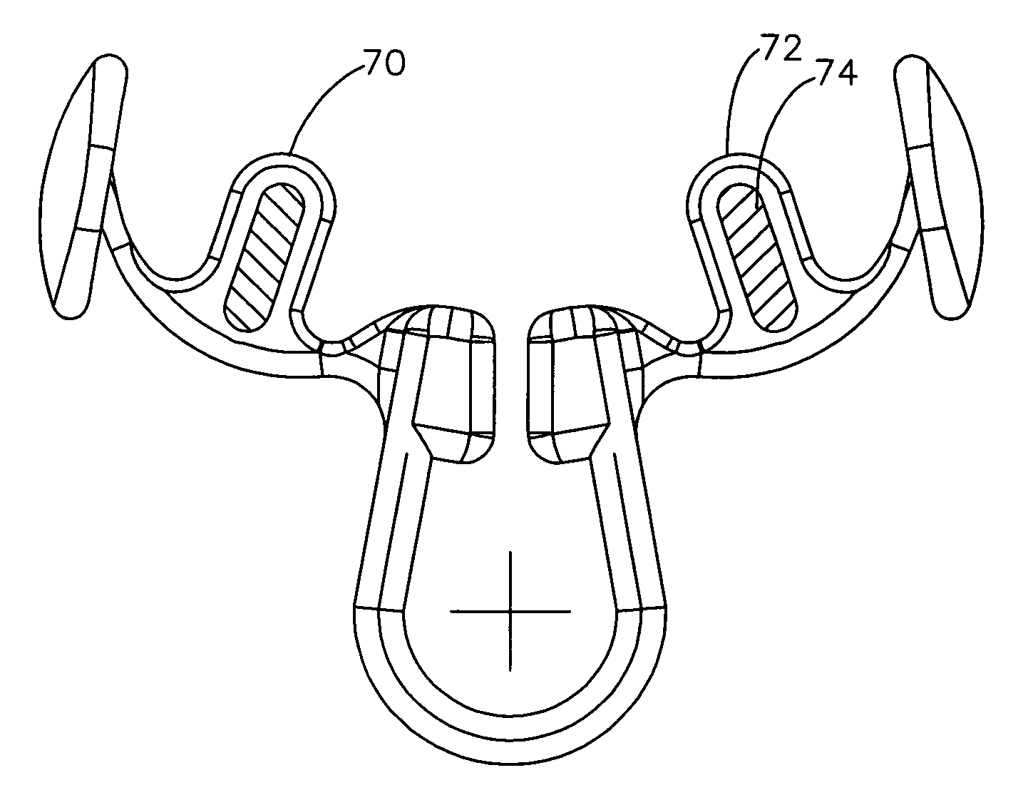 Internal nasal dilator and delivery mechanism