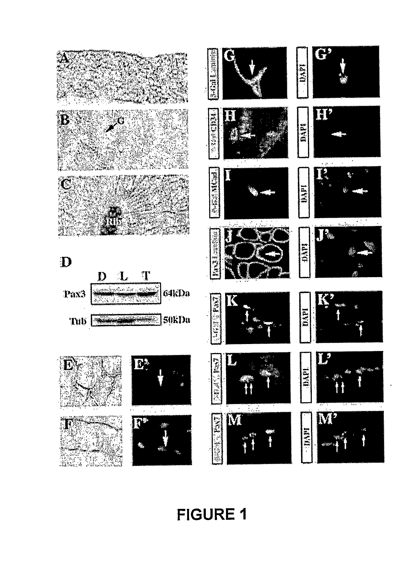 Isolated Muscle Satellite Cells, Use Thereof in Muscle Tissue Repair and Method for Isolating Said Muscle Satellite Cells