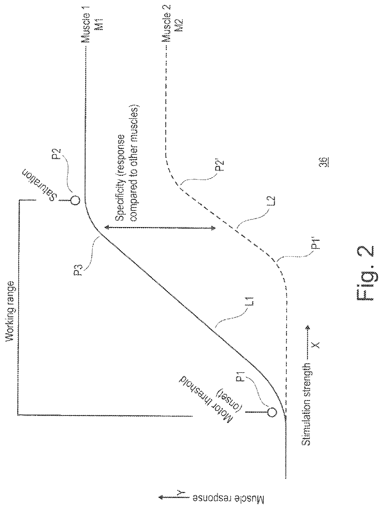 System for planning and/or providing neuromodulation, especially neurostimulation