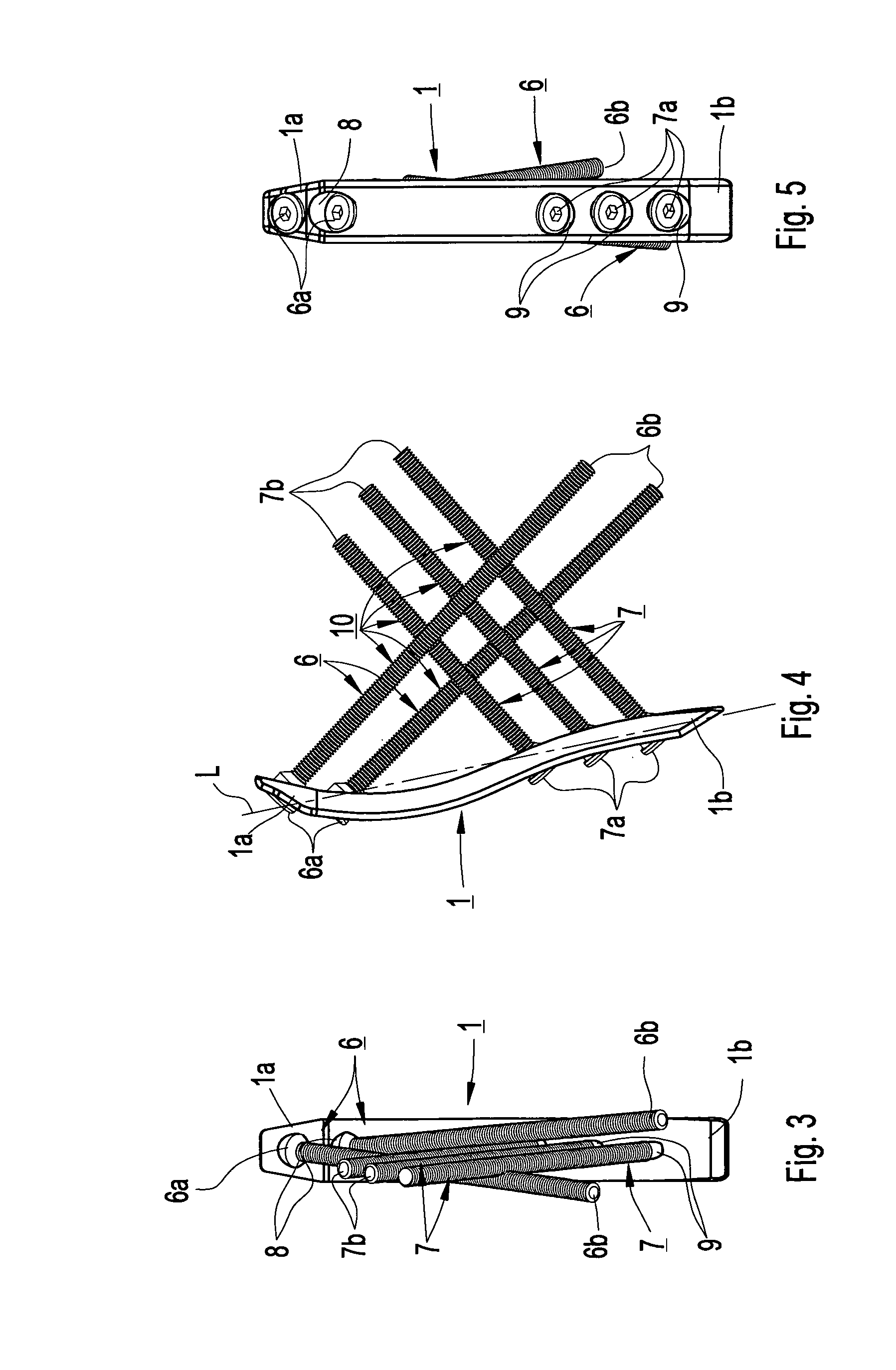 Device for internal fixation of the bone fragments in a radius fracture