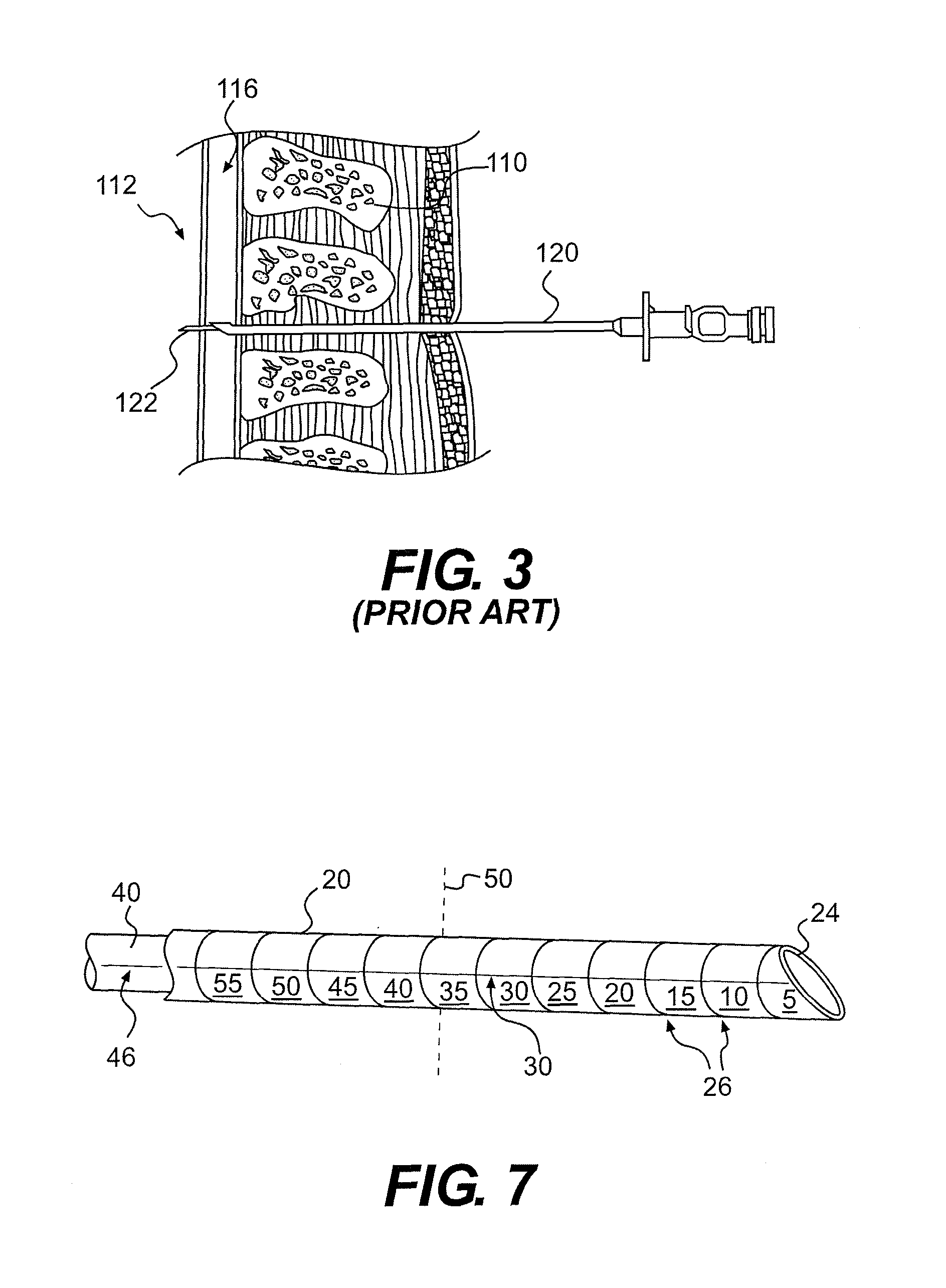 Lumbar puncture detection device