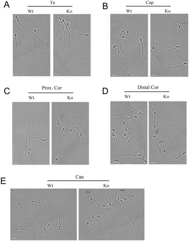 Application of EMC10 protein as biomarker in diagnosis of male infertility