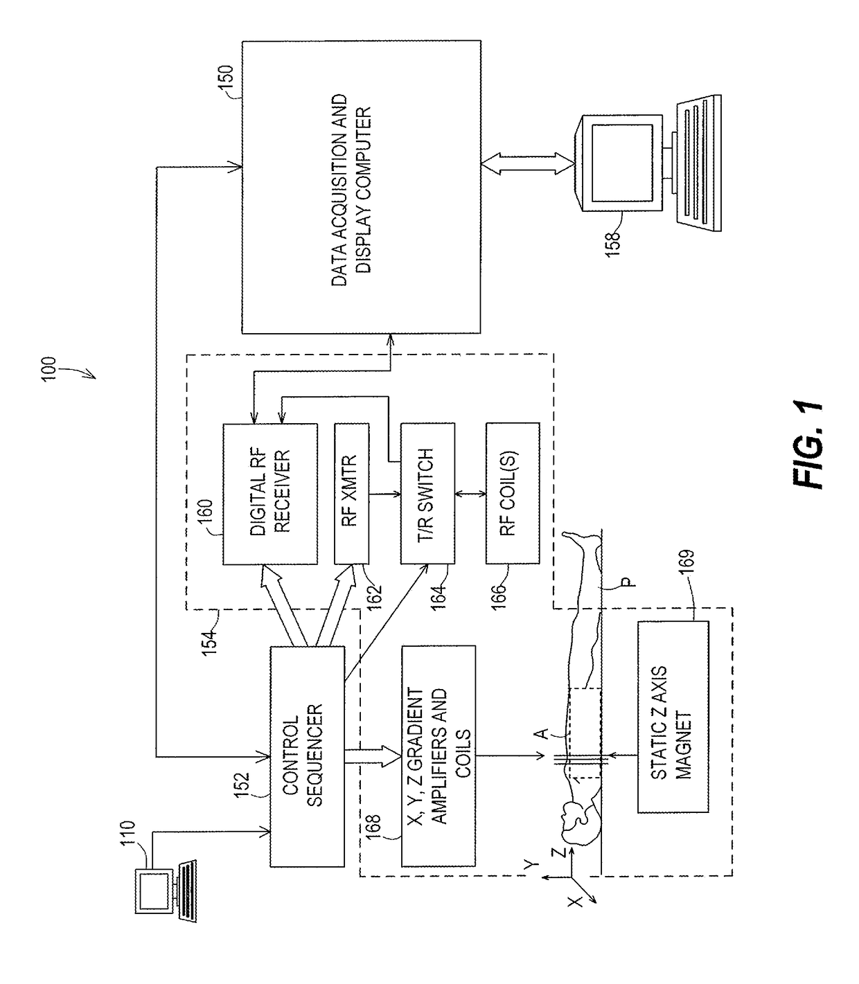 Systems and methods for magnetic resonance thermometry using balanced steady state free precession