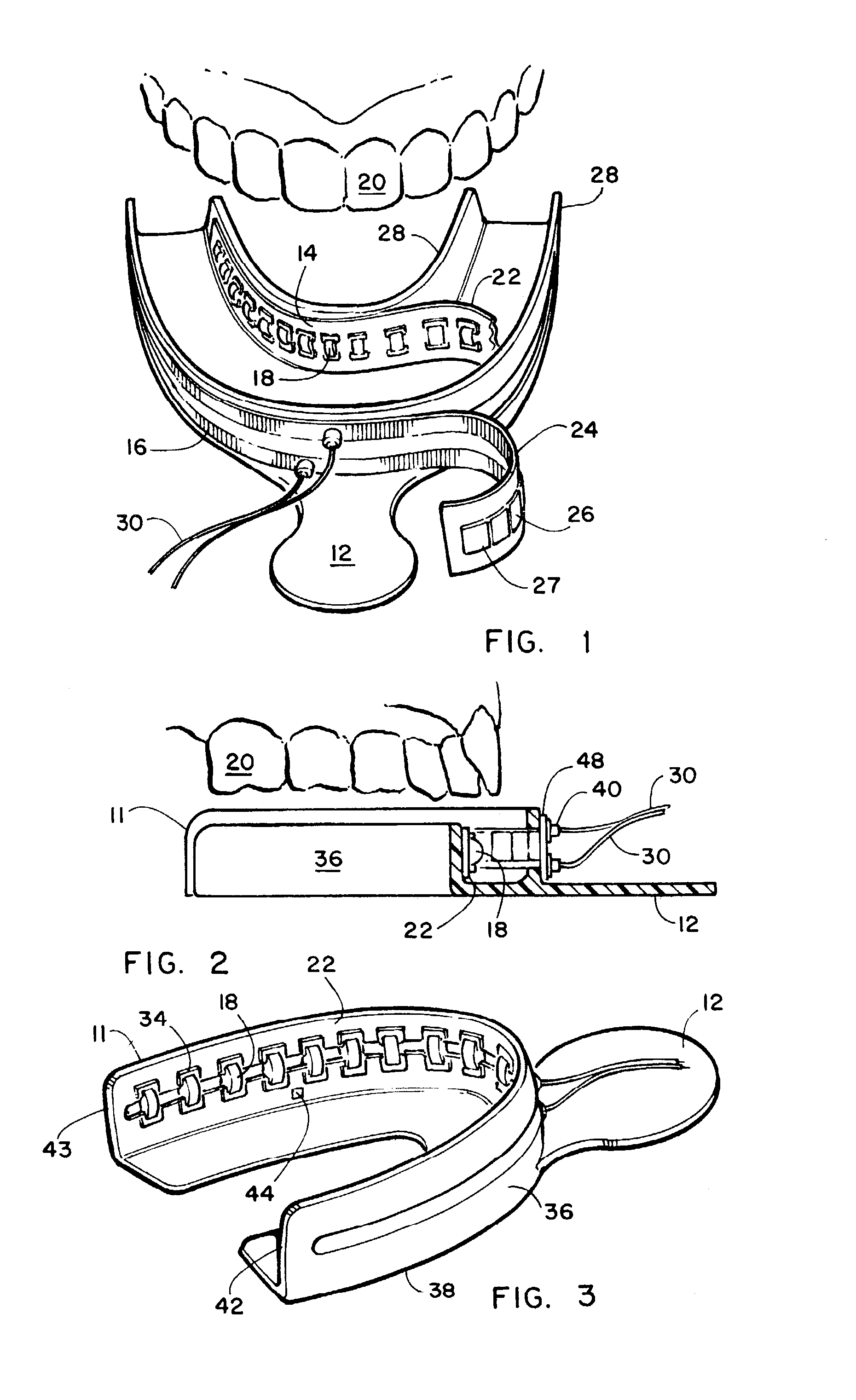 Intra oral dental irradiation device for material curing and dental imaging