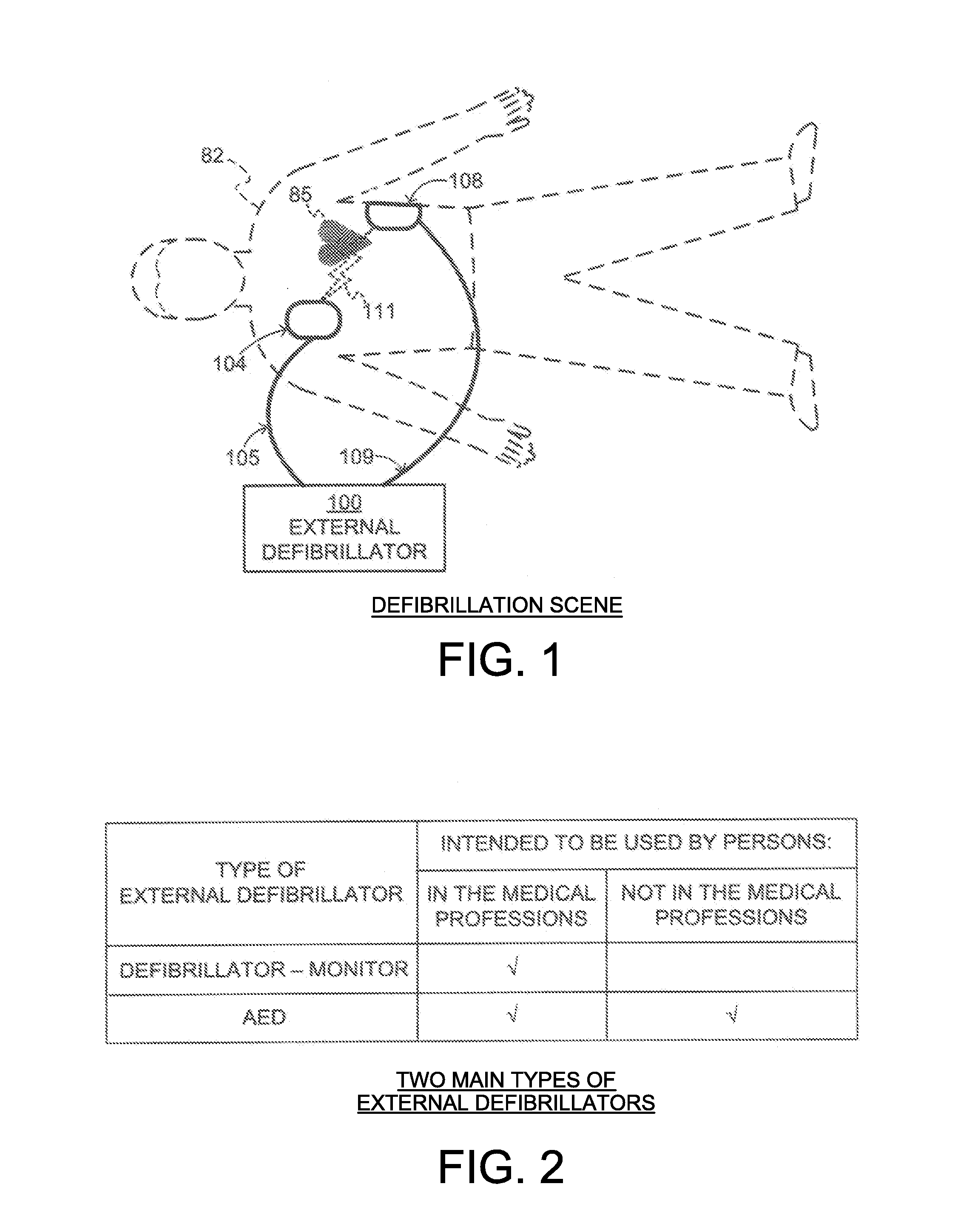 External Defibrillator Electrode, Method and System for Reducing ECG Artifact