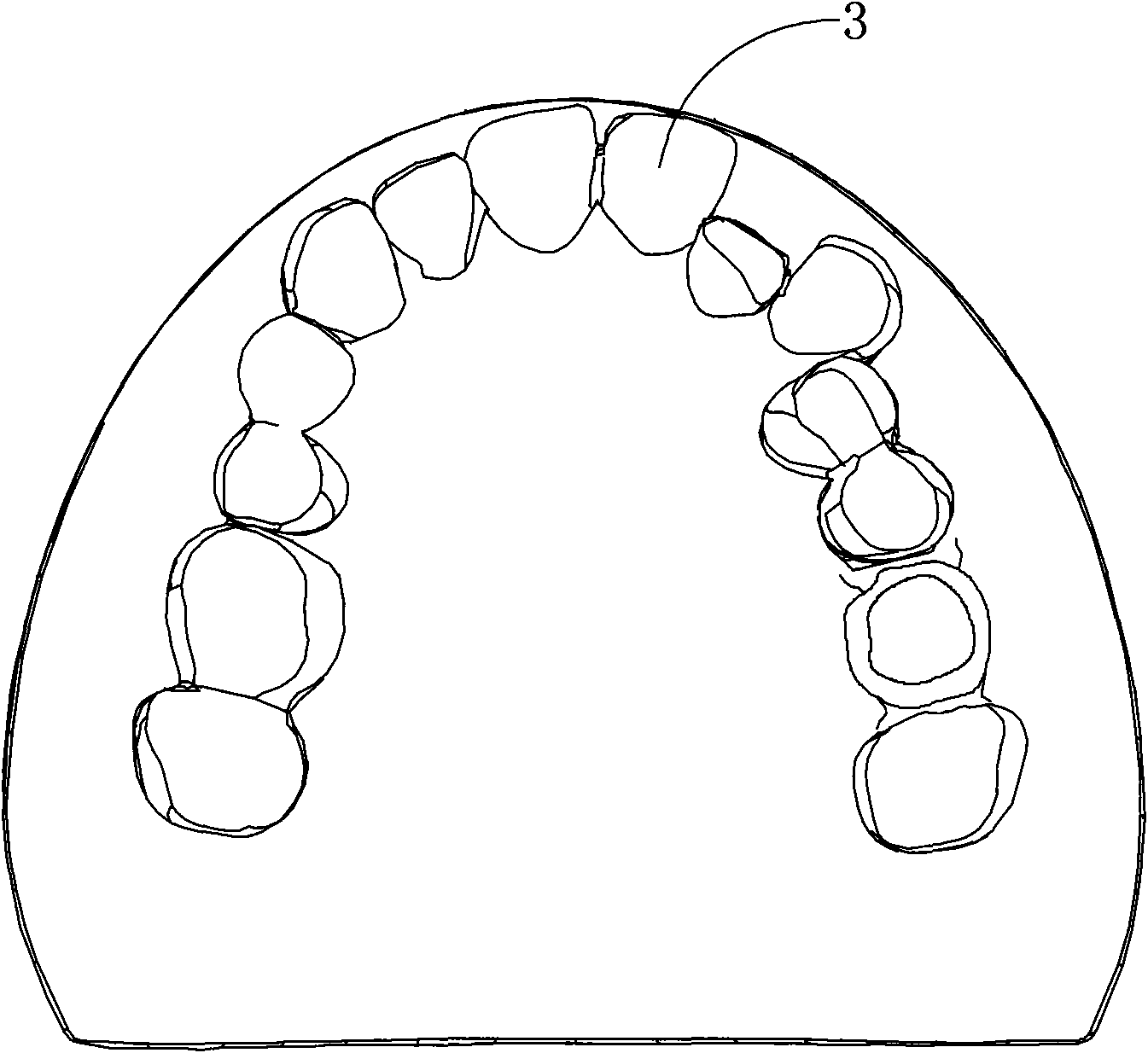 Tooth extracting model