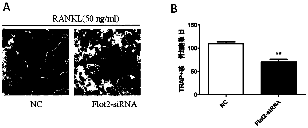Application of Flot2 inhibitor to inhibition of osteoclast formation and/or osteoclastic activity