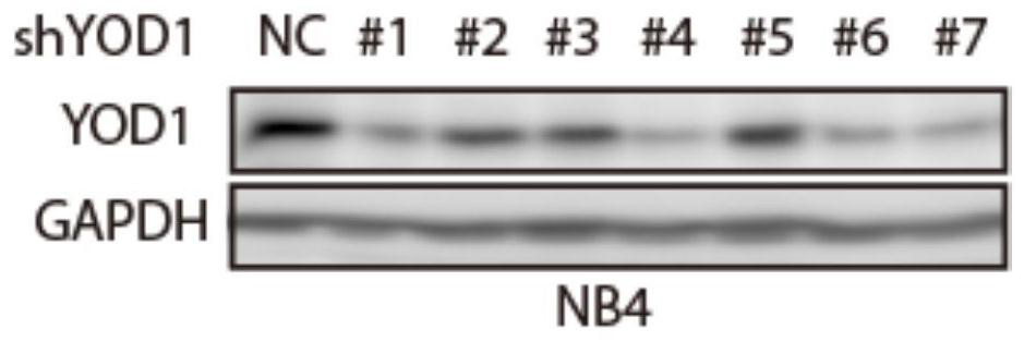 Application of yod1 gene in preparation of drugs for inducing differentiation therapy of leukemia