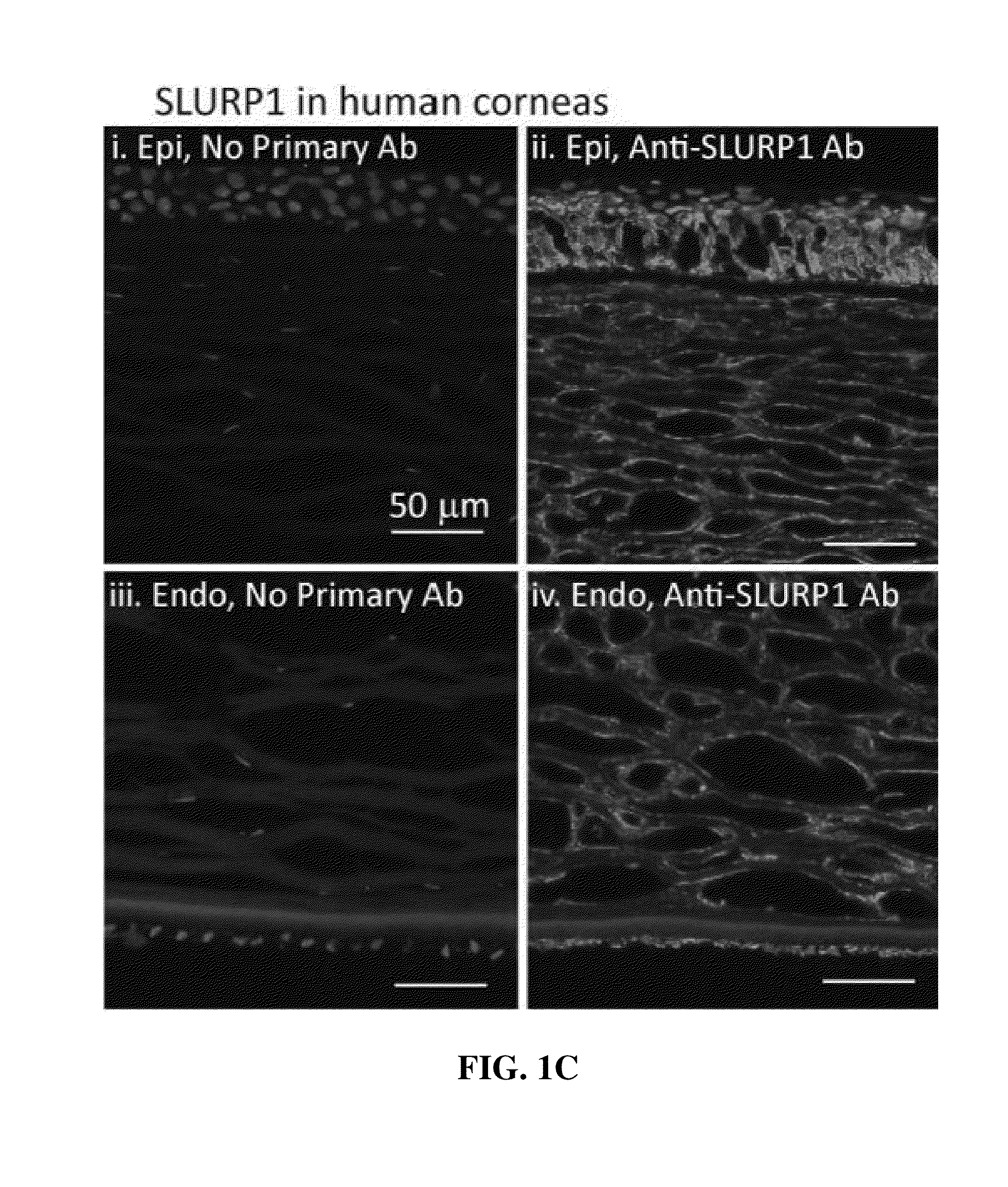 Use of slurp1 as an imunomodulatory molecule in the ocular surface