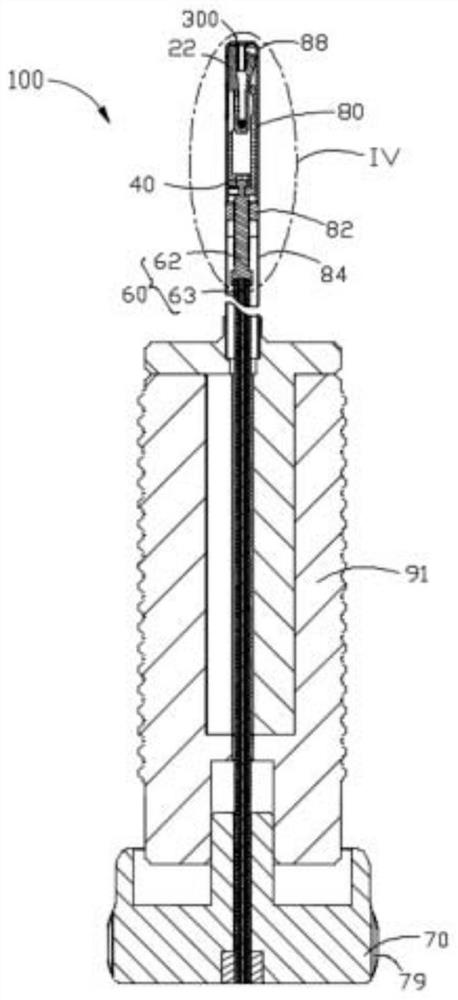 Forward push release type suture line locking device