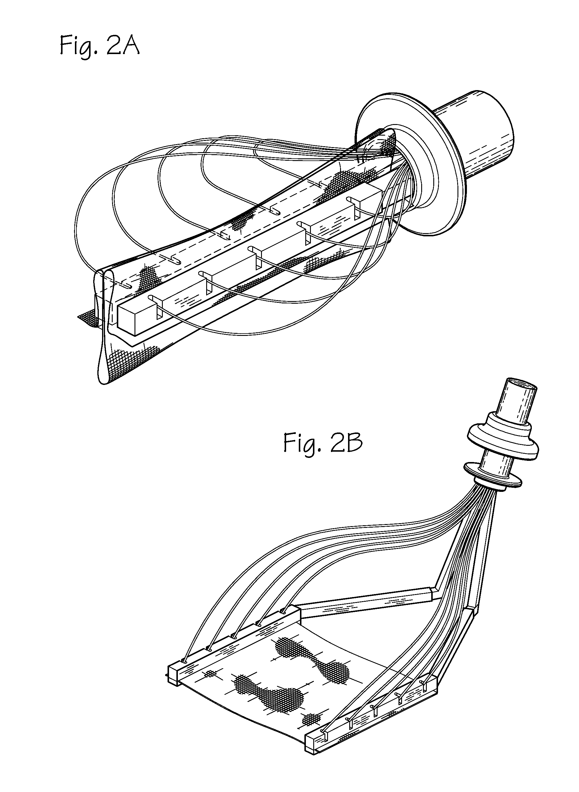 Method and Devices for Implantation of Biologic Constructs