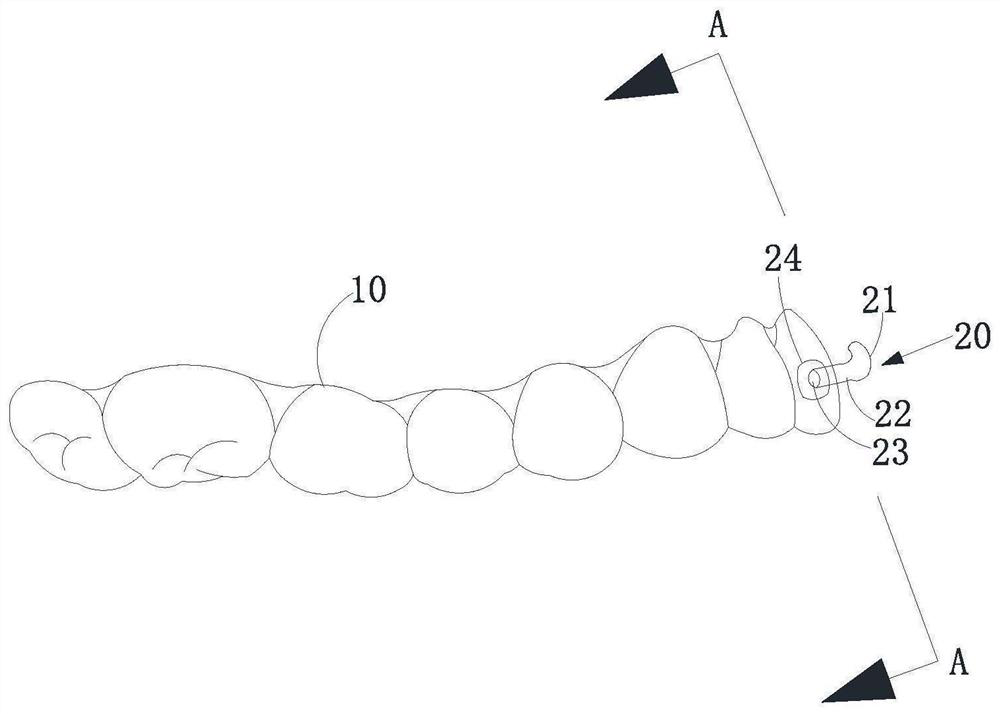 Traction device, shell-shaped dental appliance with traction device, system and set