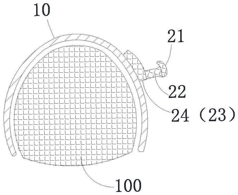 Traction device, shell-shaped dental appliance with traction device, system and set