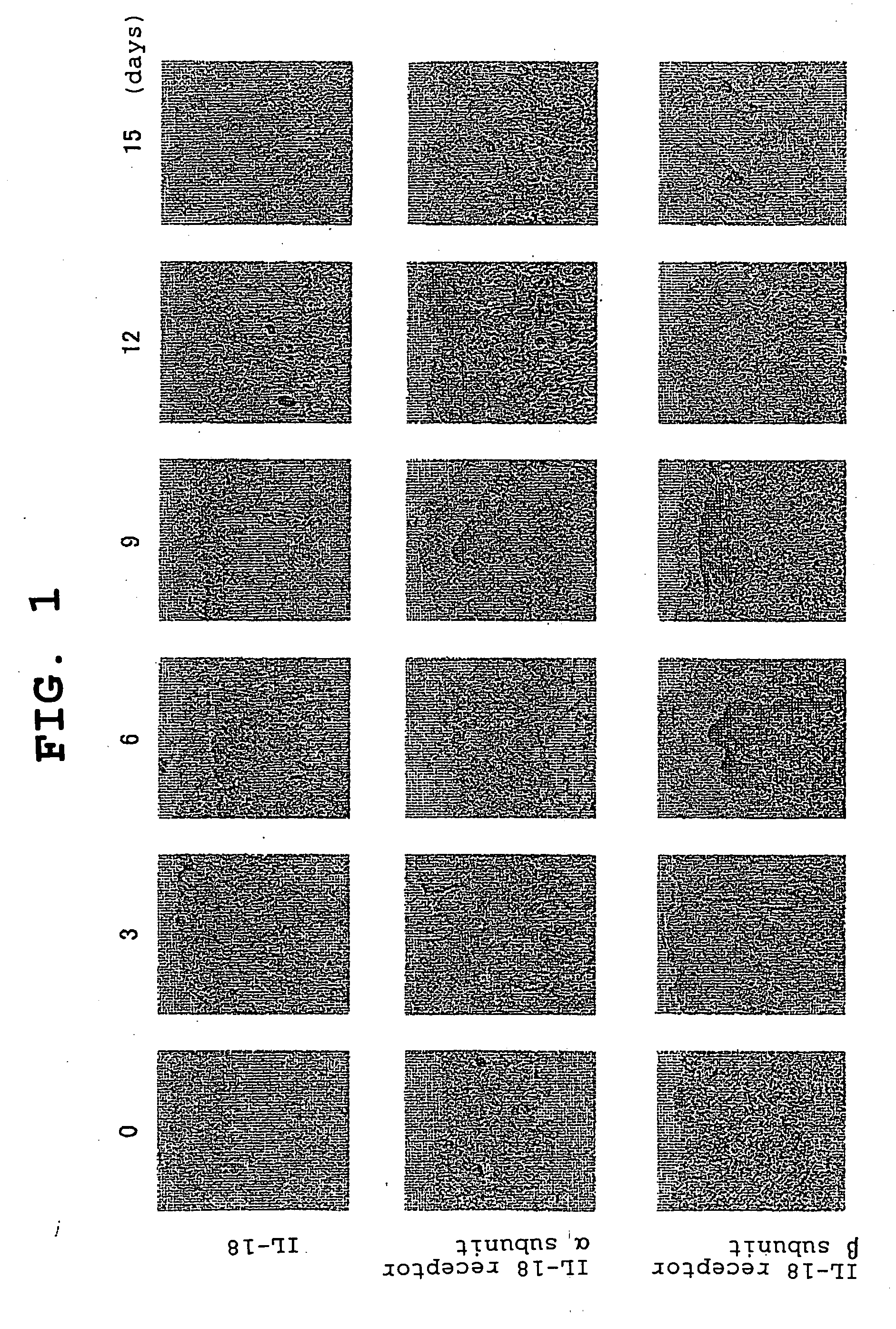 Il-18 Receptor Antagonist and Pharmaceutical Composition Containing the Antagonist