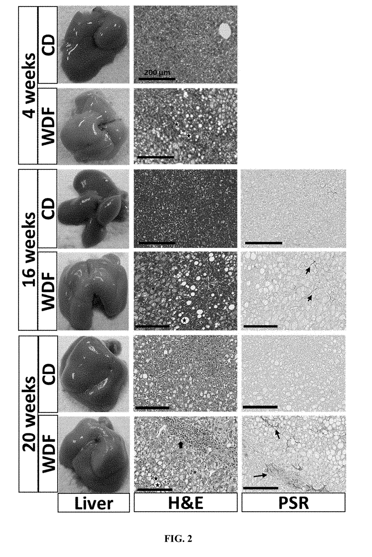 Animal models for nonalcoholic fatty liver disease