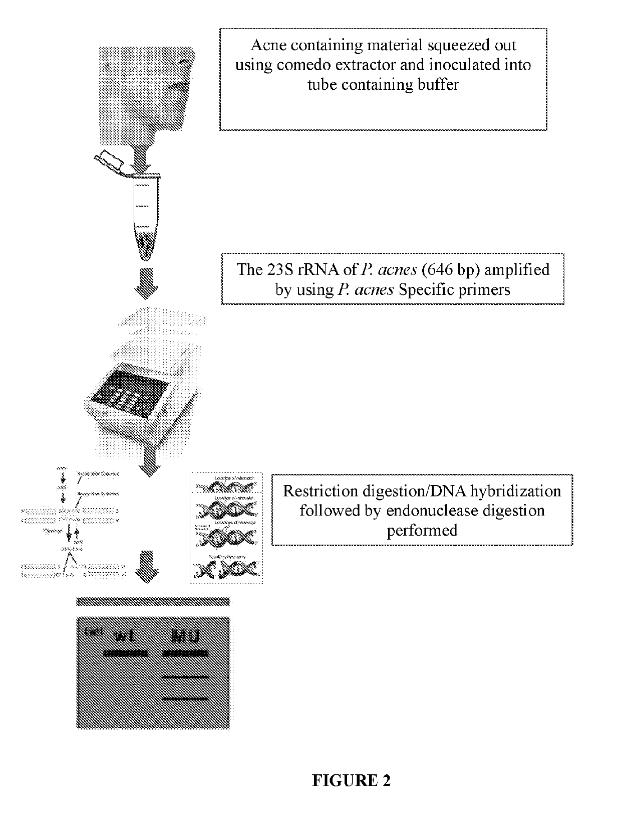 Method of detecting and treating p. acnes and kit thereof