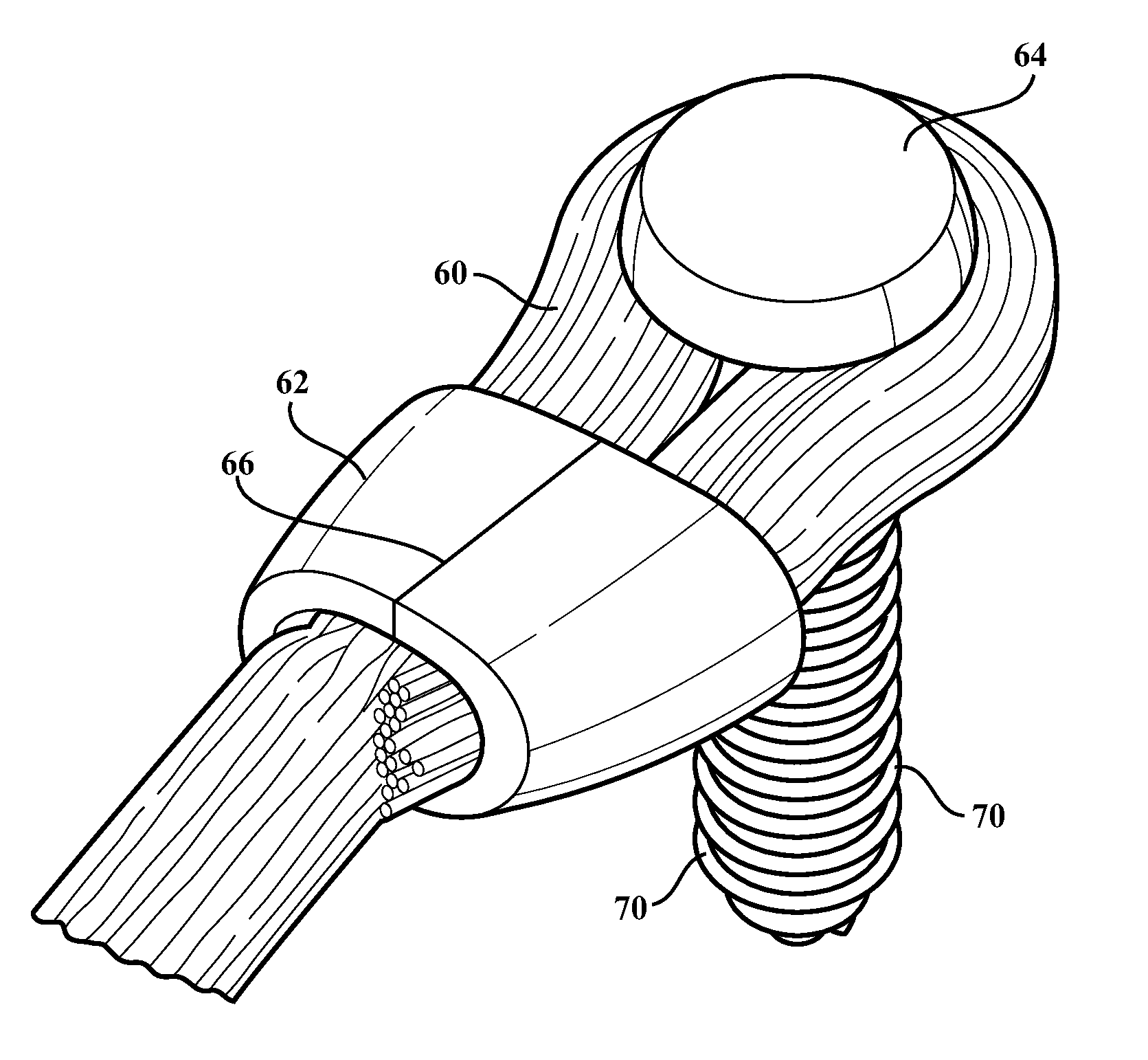 Clamping assemblies for securing ligaments to a bone