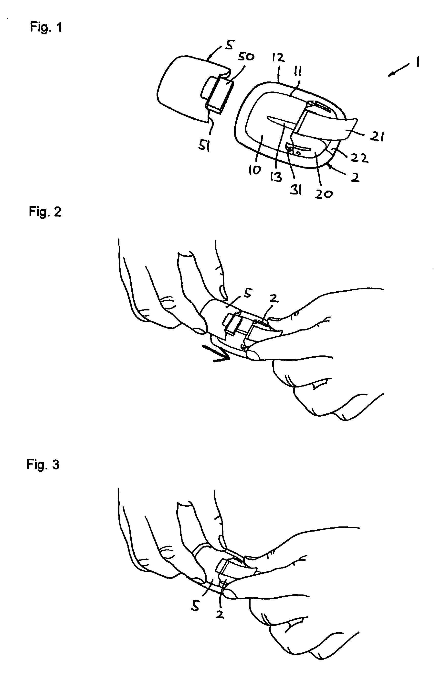 Retraction means for transcutaneous device