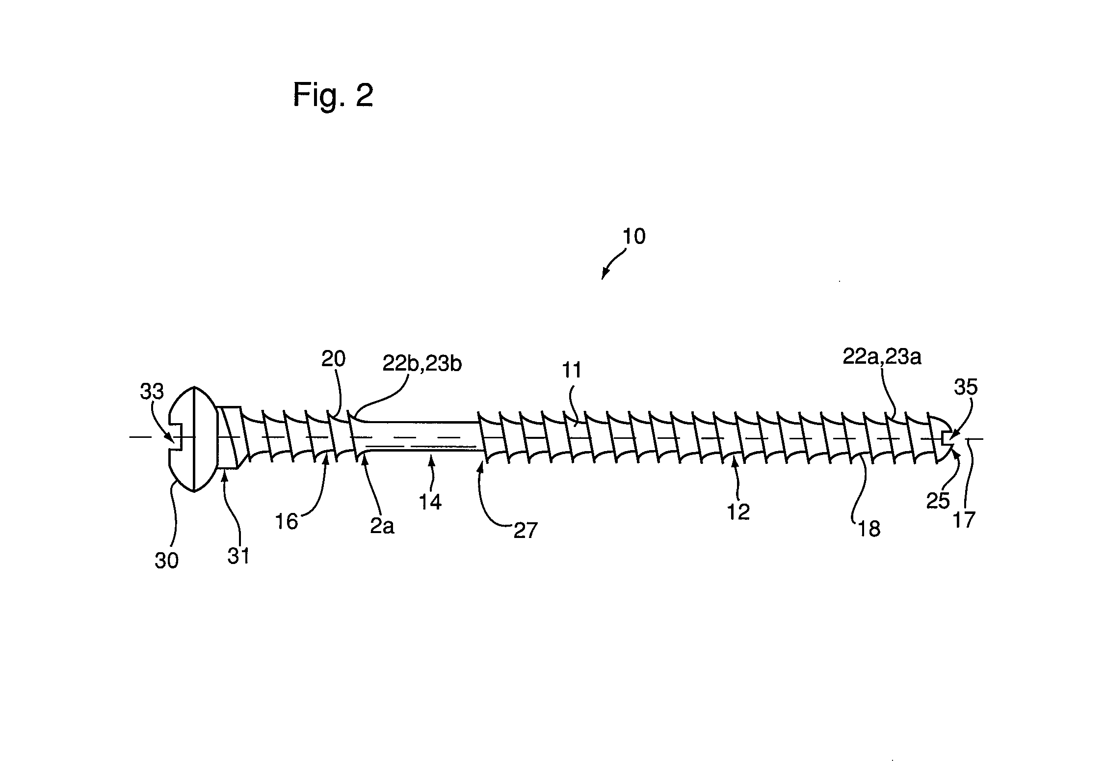 Bone fixation device and method of use thereof